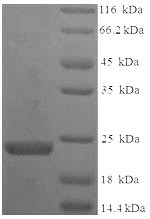(Tris-Glycine gel) Discontinuous SDS-PAGE (reduced) with 5% enrichment gel and 15% separation gel. (Tris-Glycine gel) Discontinuous SDS-PAGE (reduced) with 5% enrichment gel and 15% separation gel.