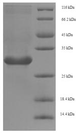 (Tris-Glycine gel) Discontinuous SDS-PAGE (reduced) with 5% enrichment gel and 15% separation gel.
