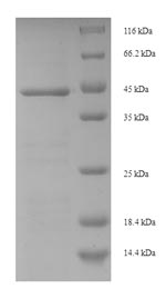 (Tris-Glycine gel) Discontinuous SDS-PAGE (reduced) with 5% enrichment gel and 15% separation gel.