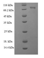 (Tris-Glycine gel) Discontinuous SDS-PAGE (reduced) with 5% enrichment gel and 15% separation gel. (Tris-Glycine gel) Discontinuous SDS-PAGE (reduced) with 5% enrichment gel and 15% separation gel.