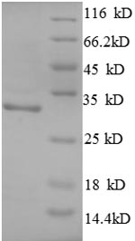 (Tris-Glycine gel) Discontinuous SDS-PAGE (reduced) with 5% enrichment gel and 15% separation gel.