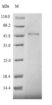 (Tris-Glycine gel) Discontinuous SDS-PAGE (reduced) with 5% enrichment gel and 15% separation gel.