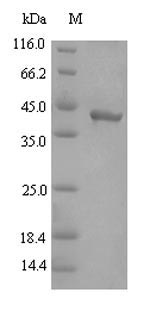 (Tris-Glycine gel) Discontinuous SDS-PAGE (reduced) with 5% enrichment gel and 15% separation gel. (Tris-Glycine gel) Discontinuous SDS-PAGE (reduced) with 5% enrichment gel and 15% separation gel.