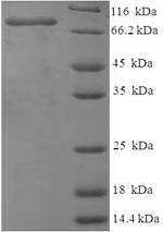 (Tris-Glycine gel) Discontinuous SDS-PAGE (reduced) with 5% enrichment gel and 15% separation gel. (Tris-Glycine gel) Discontinuous SDS-PAGE (reduced) with 5% enrichment gel and 15% separation gel.