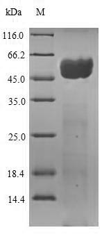 SDS-PAGE- Recombinant protein Zaire GP