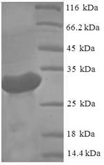 SDS-PAGE - Recombinant Hepatitis C virus genotype 1a Genome polyprotein