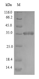 (Tris-Glycine gel) Discontinuous SDS-PAGE (reduced) with 5% enrichment gel and 15% separation gel. (Tris-Glycine gel) Discontinuous SDS-PAGE (reduced) with 5% enrichment gel and 15% separation gel.