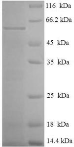 SDS-PAGE- Recombinant protein Mycoplasma p46
