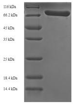 SDS-PAGE- Recombinant protein Streptococcus ply