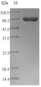 CSB-EP314820CMB SDS-PAGE