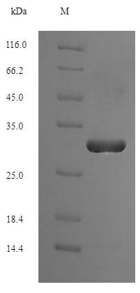 (Tris-Glycine gel) Discontinuous SDS-PAGE (reduced) with 5% enrichment gel and 15% separation gel.