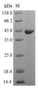 (Tris-Glycine gel) Discontinuous SDS-PAGE (reduced) with 5% enrichment gel and 15% separation gel. (Tris-Glycine gel) Discontinuous SDS-PAGE (reduced) with 5% enrichment gel and 15% separation gel.