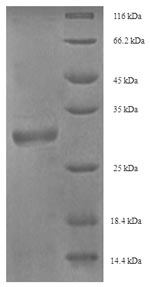 (Tris-Glycine gel) Discontinuous SDS-PAGE (reduced) with 5% enrichment gel and 15% separation gel. (Tris-Glycine gel) Discontinuous SDS-PAGE (reduced) with 5% enrichment gel and 15% separation gel.