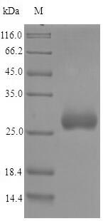 (Tris-Glycine gel) Discontinuous SDS-PAGE (reduced) with 5% enrichment gel and 15% separation gel. (Tris-Glycine gel) Discontinuous SDS-PAGE (reduced) with 5% enrichment gel and 15% separation gel.
