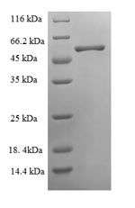 (Tris-Glycine gel) Discontinuous SDS-PAGE (reduced) with 5% enrichment gel and 15% separation gel. (Tris-Glycine gel) Discontinuous SDS-PAGE (reduced) with 5% enrichment gel and 15% separation gel.
