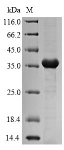 SDS-PAGE- Recombinant protein Klebsiella mrkA