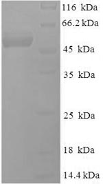 SDS-PAGE- Recombinant protein Epstein-Barr strain GD1
