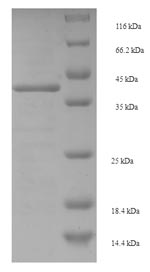 (Tris-Glycine gel) Discontinuous SDS-PAGE (reduced) with 5% enrichment gel and 15% separation gel. (Tris-Glycine gel) Discontinuous SDS-PAGE (reduced) with 5% enrichment gel and 15% separation gel.