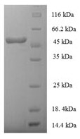 SDS-PAGE- Recombinant protein Human HLA-E