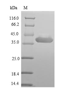 SDS-PAGE - Recombinant Rotavirus A Outer capsid protein VP4,E.coli