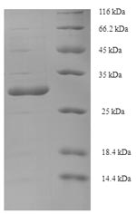 (Tris-Glycine gel) Discontinuous SDS-PAGE (reduced) with 5% enrichment gel and 15% separation gel.