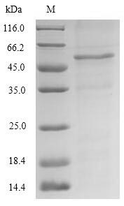 (Tris-Glycine gel) Discontinuous SDS-PAGE (reduced) with 5% enrichment gel and 15% separation gel. (Tris-Glycine gel) Discontinuous SDS-PAGE (reduced) with 5% enrichment gel and 15% separation gel.