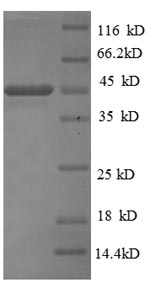 (Tris-Glycine gel) Discontinuous SDS-PAGE (reduced) with 5% enrichment gel and 15% separation gel. (Tris-Glycine gel) Discontinuous SDS-PAGE (reduced) with 5% enrichment gel and 15% separation gel.