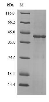 (Tris-Glycine gel) Discontinuous SDS-PAGE (reduced) with 5% enrichment gel and 15% separation gel.