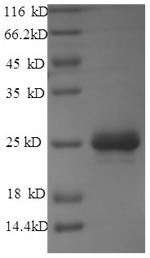 SDS-PAGE- Recombinant protein Streptomyces bar