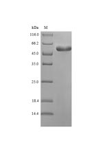 (Tris-Glycine gel) Discontinuous SDS-PAGE (reduced) with 5% enrichment gel and 15% separation gel. (Tris-Glycine gel) Discontinuous SDS-PAGE (reduced) with 5% enrichment gel and 15% separation gel.