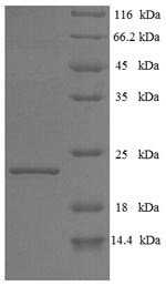 (Tris-Glycine gel) Discontinuous SDS-PAGE (reduced) with 5% enrichment gel and 15% separation gel. (Tris-Glycine gel) Discontinuous SDS-PAGE (reduced) with 5% enrichment gel and 15% separation gel.