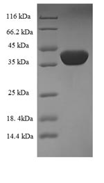 SDS-PAGE- Recombinant protein Escherichia nfsA