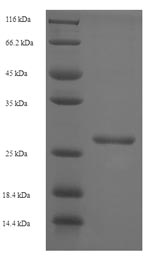 SDS-PAGE- Recombinant protein Simian vpx