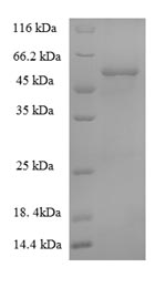 (Tris-Glycine gel) Discontinuous SDS-PAGE (reduced) with 5% enrichment gel and 15% separation gel.