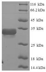 SDS-PAGE- Recombinant protein Glycine GM2S-1