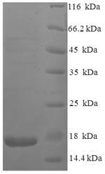 SDS-PAGE- Recombinant protein Human vpx