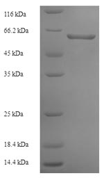 (Tris-Glycine gel) Discontinuous SDS-PAGE (reduced) with 5% enrichment gel and 15% separation gel. (Tris-Glycine gel) Discontinuous SDS-PAGE (reduced) with 5% enrichment gel and 15% separation gel.