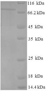 (Tris-Glycine gel) Discontinuous SDS-PAGE (reduced) with 5% enrichment gel and 15% separation gel. (Tris-Glycine gel) Discontinuous SDS-PAGE (reduced) with 5% enrichment gel and 15% separation gel.