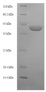 (Tris-Glycine gel) Discontinuous SDS-PAGE (reduced) with 5% enrichment gel and 15% separation gel.