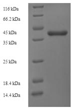 (Tris-Glycine gel) Discontinuous SDS-PAGE (reduced) with 5% enrichment gel and 15% separation gel.