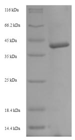(Tris-Glycine gel) Discontinuous SDS-PAGE (reduced) with 5% enrichment gel and 15% separation gel. (Tris-Glycine gel) Discontinuous SDS-PAGE (reduced) with 5% enrichment gel and 15% separation gel.