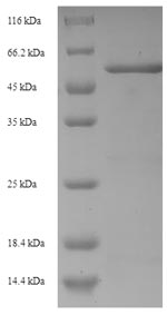 (Tris-Glycine gel) Discontinuous SDS-PAGE (reduced) with 5% enrichment gel and 15% separation gel.