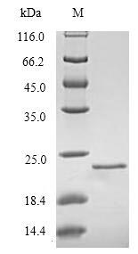 (Tris-Glycine gel) Discontinuous SDS-PAGE (reduced) with 5% enrichment gel and 15% separation gel. (Tris-Glycine gel) Discontinuous SDS-PAGE (reduced) with 5% enrichment gel and 15% separation gel.