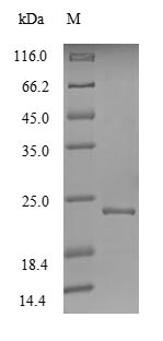 (Tris-Glycine gel) Discontinuous SDS-PAGE (reduced) with 5% enrichment gel and 15% separation gel. (Tris-Glycine gel) Discontinuous SDS-PAGE (reduced) with 5% enrichment gel and 15% separation gel.