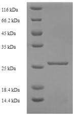 (Tris-Glycine gel) Discontinuous SDS-PAGE (reduced) with 5% enrichment gel and 15% separation gel. (Tris-Glycine gel) Discontinuous SDS-PAGE (reduced) with 5% enrichment gel and 15% separation gel.