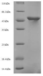 (Tris-Glycine gel) Discontinuous SDS-PAGE (reduced) with 5% enrichment gel and 15% separation gel. (Tris-Glycine gel) Discontinuous SDS-PAGE (reduced) with 5% enrichment gel and 15% separation gel.