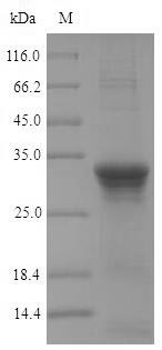 (Tris-Glycine gel) Discontinuous SDS-PAGE (reduced) with 5% enrichment gel and 15% separation gel.
