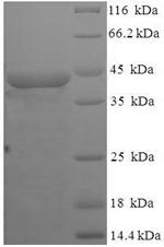 (Tris-Glycine gel) Discontinuous SDS-PAGE (reduced) with 5% enrichment gel and 15% separation gel.