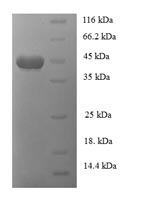 (Tris-Glycine gel) Discontinuous SDS-PAGE (reduced) with 5% enrichment gel and 15% separation gel.