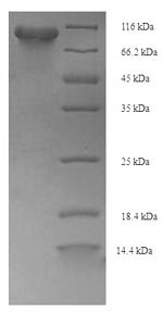 (Tris-Glycine gel) Discontinuous SDS-PAGE (reduced) with 5% enrichment gel and 15% separation gel. (Tris-Glycine gel) Discontinuous SDS-PAGE (reduced) with 5% enrichment gel and 15% separation gel.